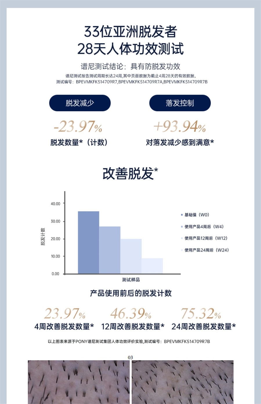 【中国直邮】艾诗摩尔  射频健发梳红光激防密脱头皮护理按摩增育养护电动发生仪  海渐蓝