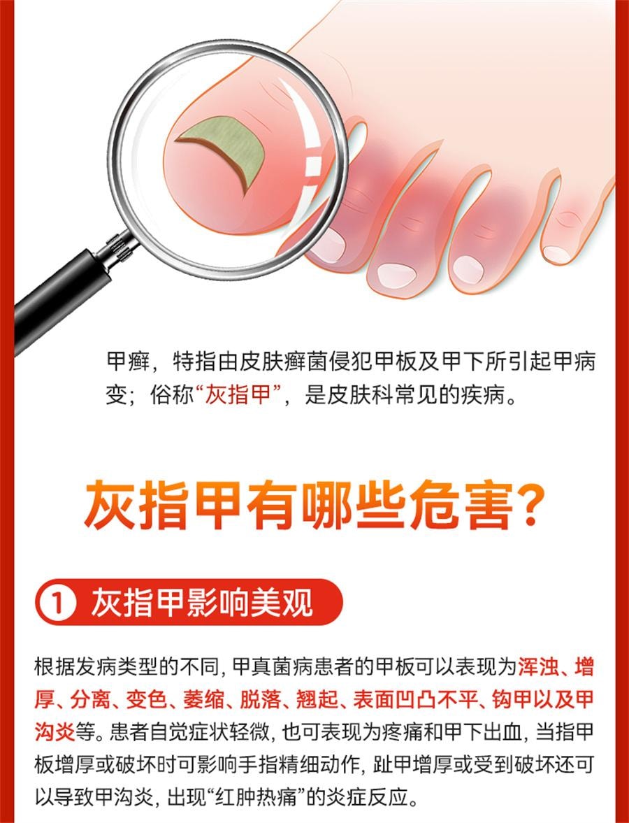 【中国直邮】 太平 硝酸咪康唑乳膏 治疗灰指甲专用药甲硝酸咪康唑乳膏烂脚丫10g/盒