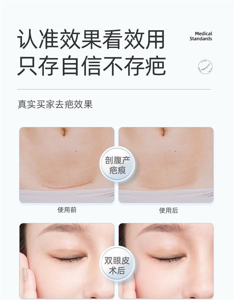 【中國直郵】 舒奈美 矽凝膠疤痕敷料修護貼矽酮傷疤痘印遮瑕貼膚色防水透氣 3片裝/盒