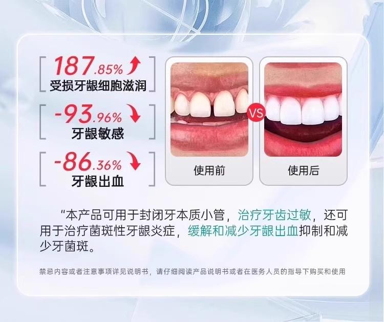 【中國直郵】 醫用口腔護理脫敏膏 120g/支 舒緩牙齦敏感 輔助維護牙周健康