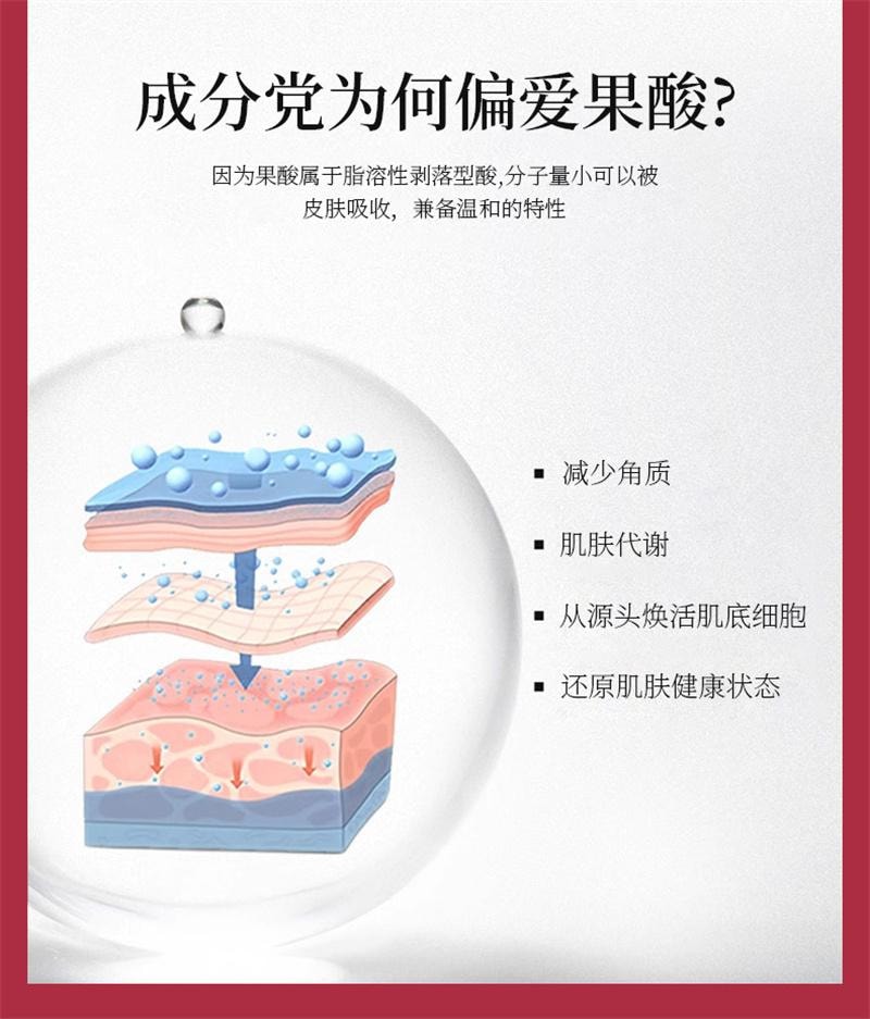 臻羞 果酸水楊酸收縮毛孔粗大修復護精華液刷面部酸淡化祛黑頭閉口粉刺 溫和剝脫老廢角質,疏通毛孔,改善閉口、粉刺、痘痘與粗糙膚質30ml