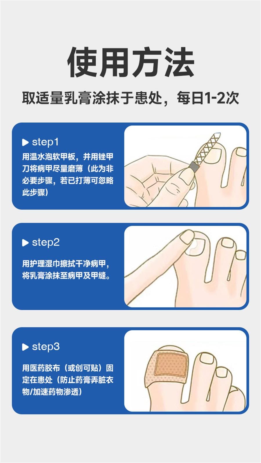  恒医森 灰指甲用药环吡酮胺乳膏治疗灰指甲甲癣脚气股癣花斑癣   20g/支