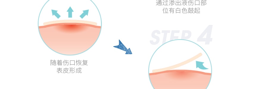 台湾3M NEXCARE 痘痘隐形贴 综合型大小痘通用型 46枚入