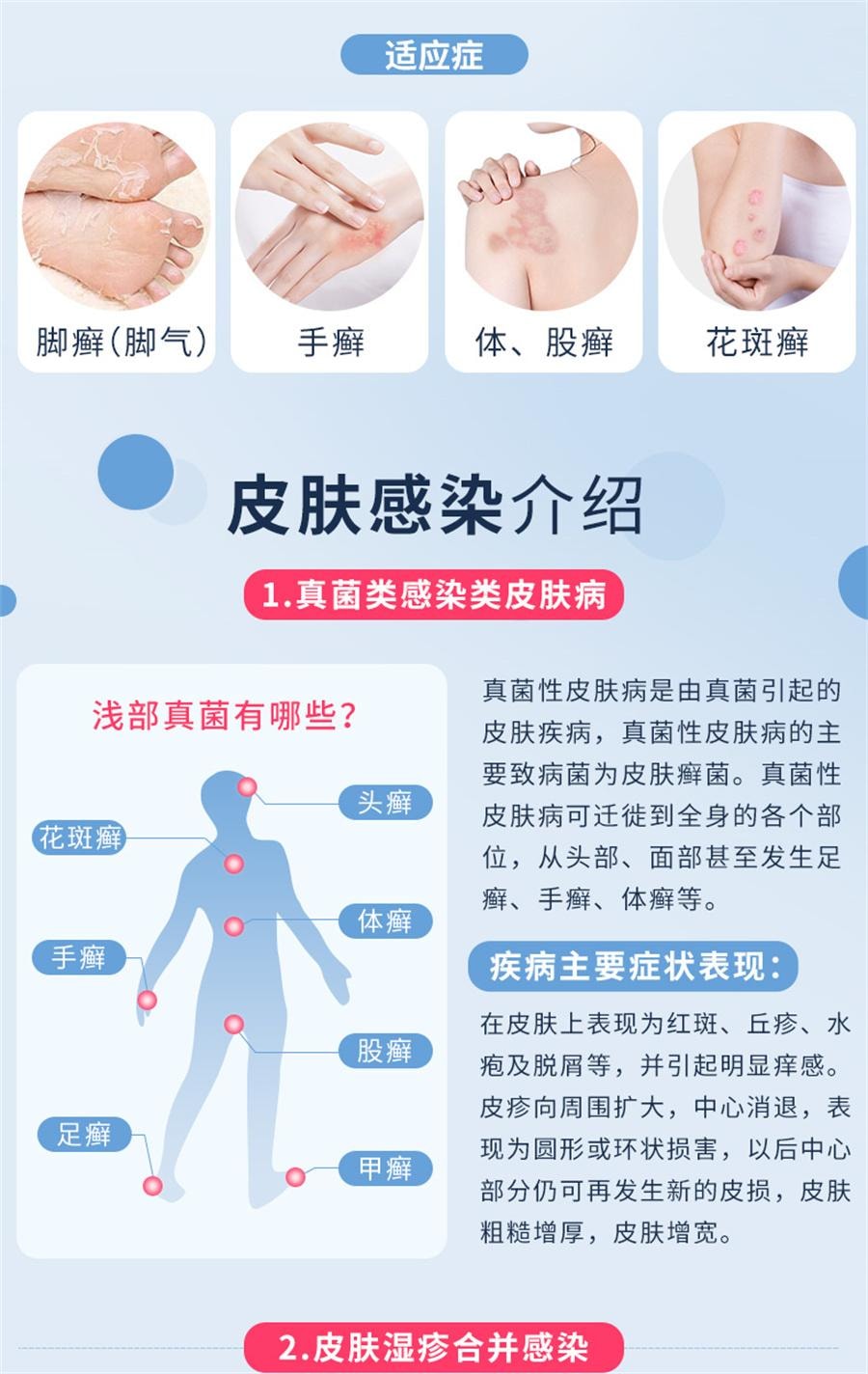 【中国直邮】 川石 复方克霉唑乳膏 用于脚气干裂止痒手藓真菌感染药膏20g/盒