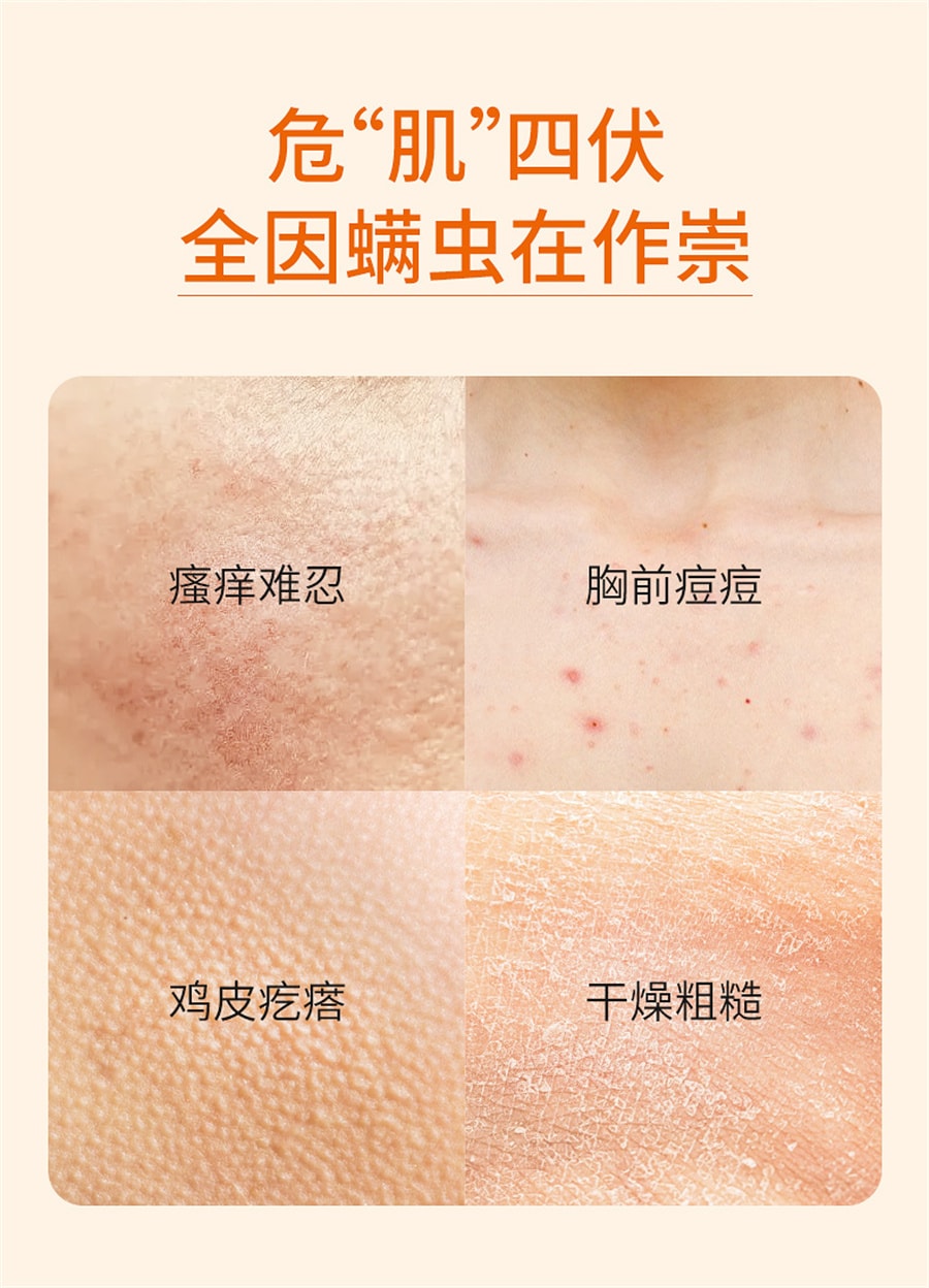 【中國直郵】肌膚之食 除蟎沐浴露背部去蟎蟲控油持久留香男女可用祛痘沐浴液 500ml/瓶