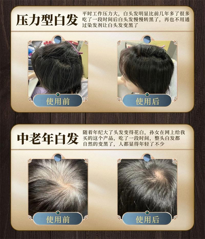 【中国直邮】 本草纲目 七宝美髯丹丸美鬓盗汗须发早白筋骨软弱肝肾脱发 60g/盒