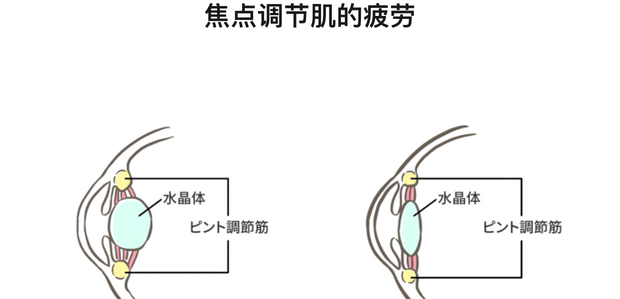 日本Santen 參天製藥Soft Santear裸眼隱形眼鏡兩用緩解眼疲勞眼藥水5ml×2瓶