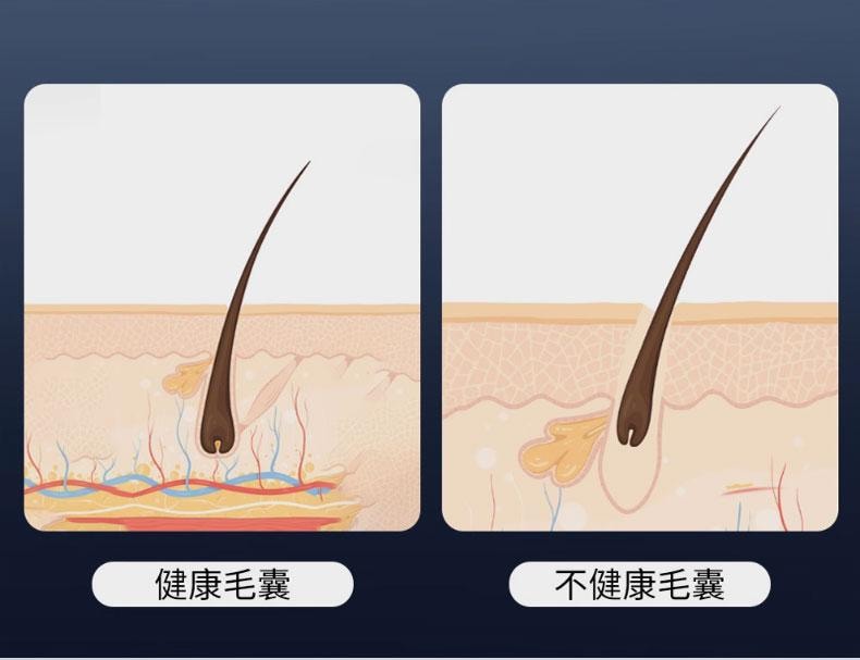 【中國直郵】 晶雅家 頭皮上藥器米諾上藥器滾珠紅藍光電動按摩梳生發育髮梳 黑色 170g 一台裝