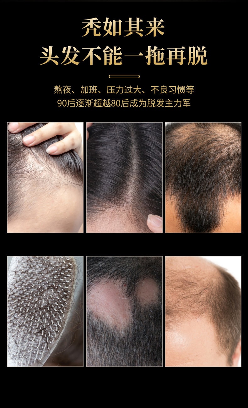【中國直郵】北京同仁堂 防脫發育髮液增髮密髮固髮頭髮長髮劑禿頭髮際線男女生髮液 100ml