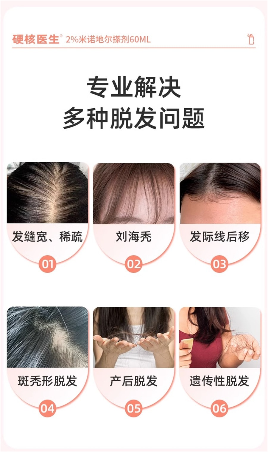 【中國直郵】硬核醫師 女性專用2%米諾地爾搽劑酊生髮液育發防掉髮擦劑町 60ml/盒