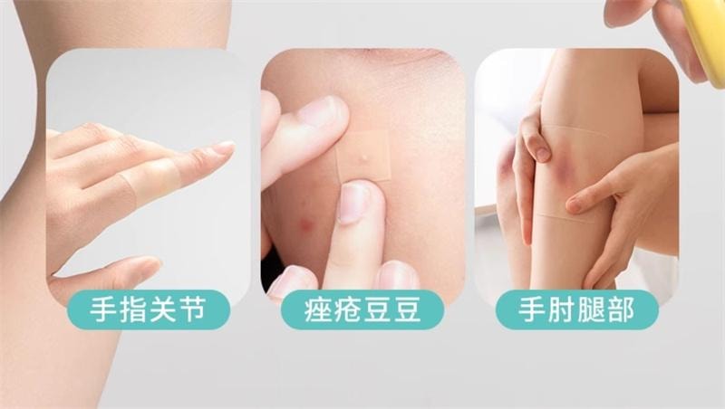 【中国直邮】 海氏海诺 医用水胶体敷料5片/盒 人工皮伤口愈合净痘人造皮肤贴大片痘痘贴