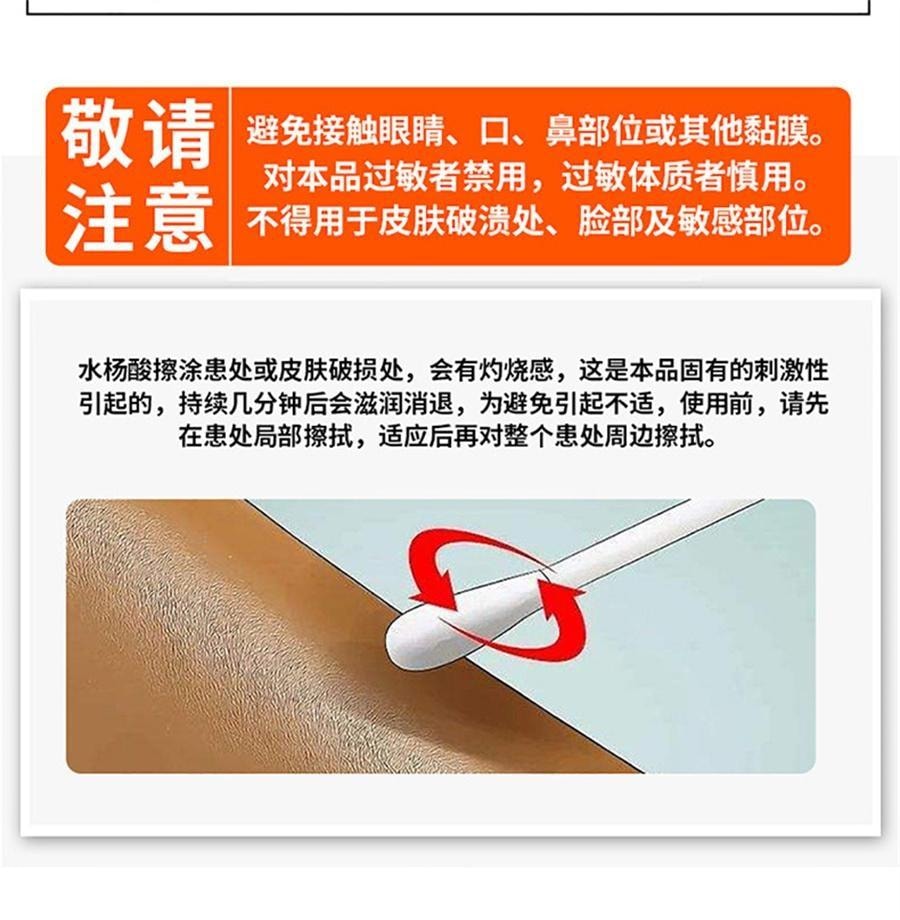 【中国直邮】 欧诺康 复方水杨酸溶液 用于真菌去角质手足脚死皮擦涂剂克星搽剂 100ml/盒