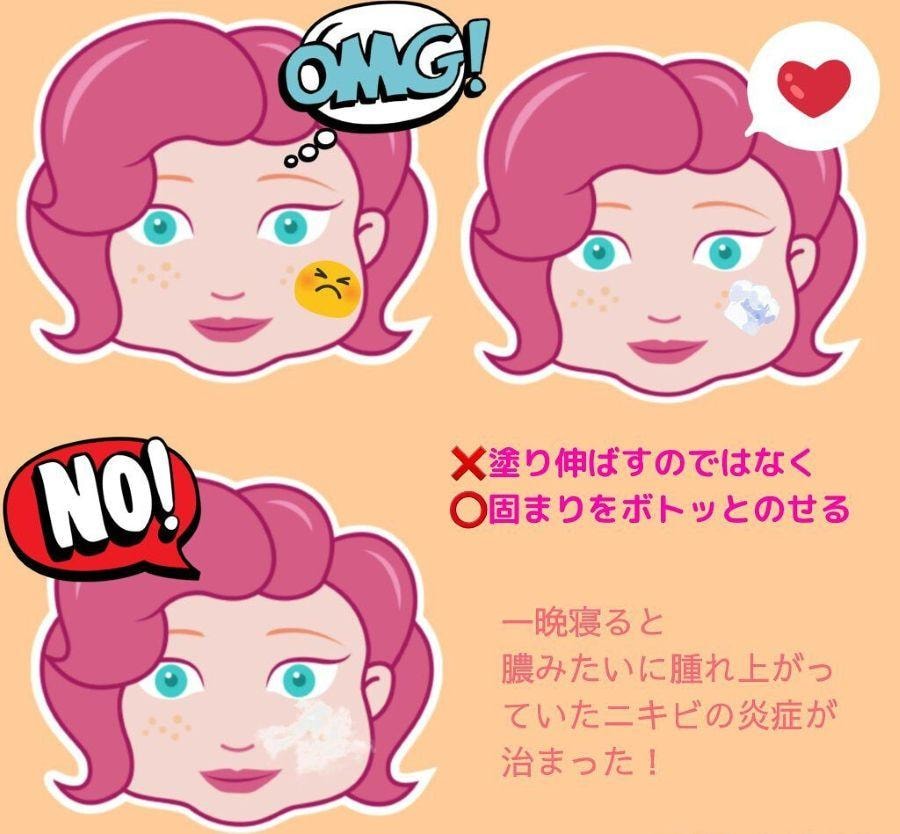 【日本直郵】 日本 SHISEIDO 資生堂 IHADA皮膚祛痘膏 16g