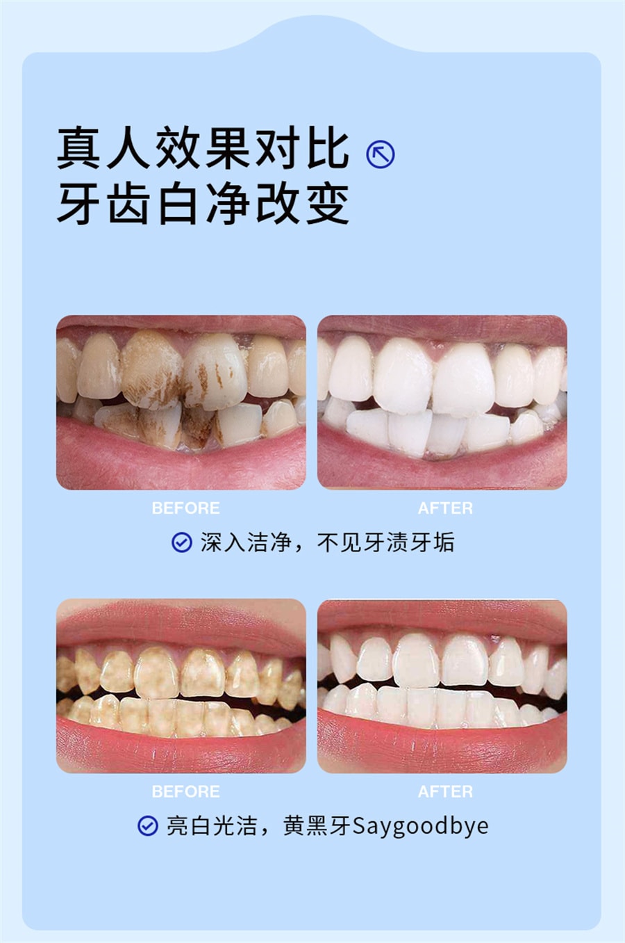 【中國直郵】EHD 潔牙粉去黃洗白減少異味牙菌斑清新口氣牙漬美牙垢白 50g/盒