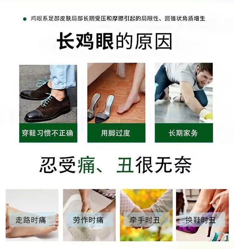 云南本草 鸡眼膏抑菌膏去鸡眼膏跖疣瘊子肉刺老茧除鸡眼贴 20g/盒(建议拍6支)