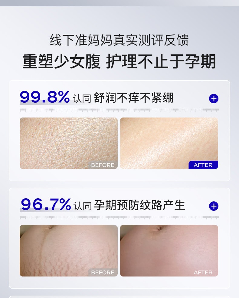 【中國直郵】 華美科 妊娠紋孕婦修補霜 祛肥胖紋淡化藥膏 產後專用消除浬花緊緻肚皮 50g/瓶