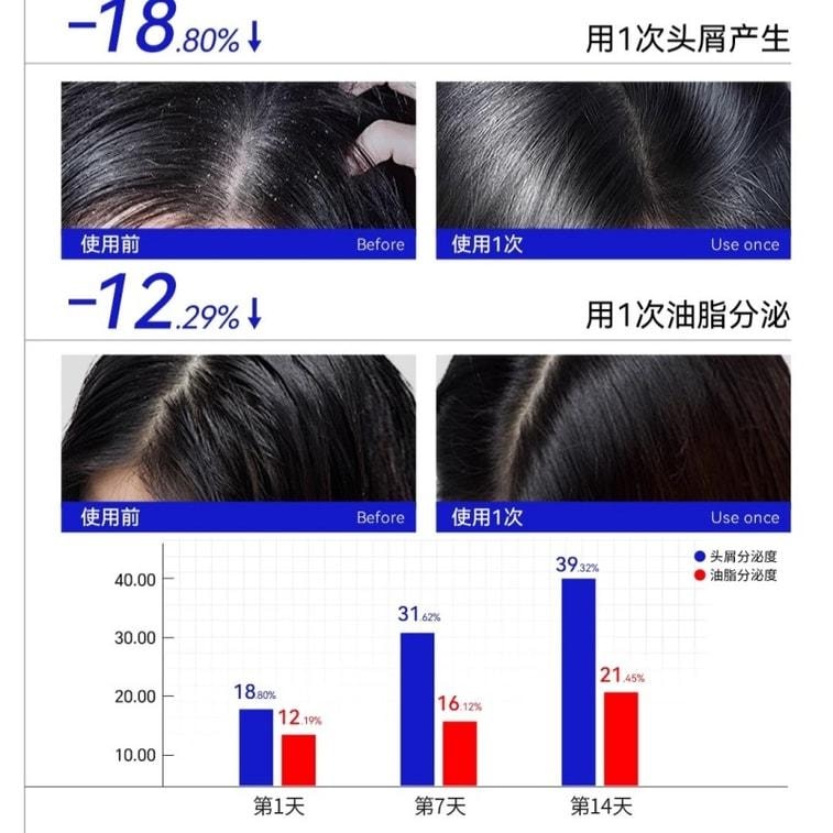 【中國直郵】 EHD 二硫化硒控油去屑洗髮精 毛囊清潔蓬鬆洗頭露膏男女 400ml