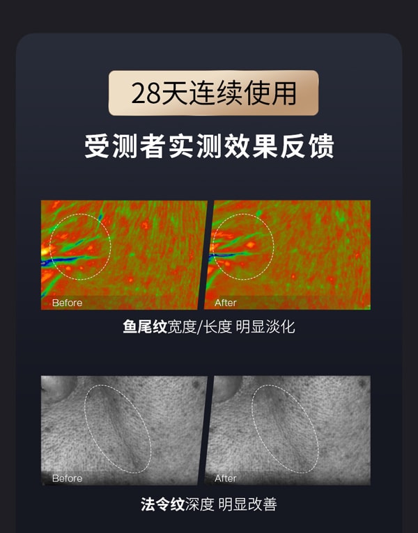 【年中特惠】中國直郵AMIRO覓食R1PRO六級射頻美容儀RF家用提拉緊緻嫩膚臉面部神器雲影黑送凝膠*2