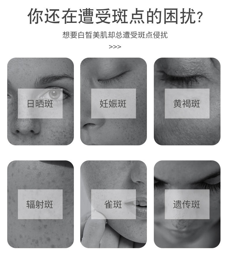 【中國直郵】南京同仁堂 去雀斑黃褐斑美白祛斑霜 20g