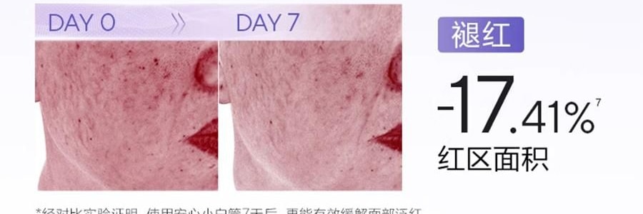 OSM歐詩漫 安心小白管 舒緩美白面部次拋精華 1.2ml*30支 祛斑強韌屏障 擊退泛紅 修護敏感