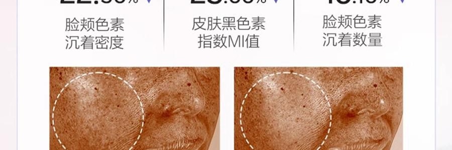 OSM歐詩漫 安心小白管 舒緩美白面部次拋精華 1.2ml*30支 祛斑強韌屏障 擊退泛紅 修護敏感