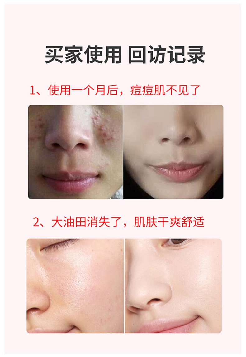 中国 K·SKIN金稻 电动洗脸刷 面部清洁器 粉色 1台
