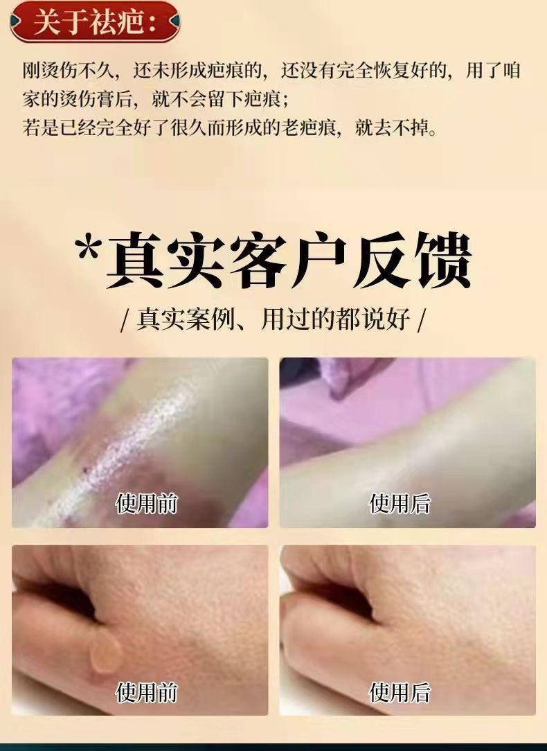  祥醫堂 獾油燙傷膏15g/盒 修護肌膚、止痛消腫、溫和舒緩、燙傷燒傷疤痕膏