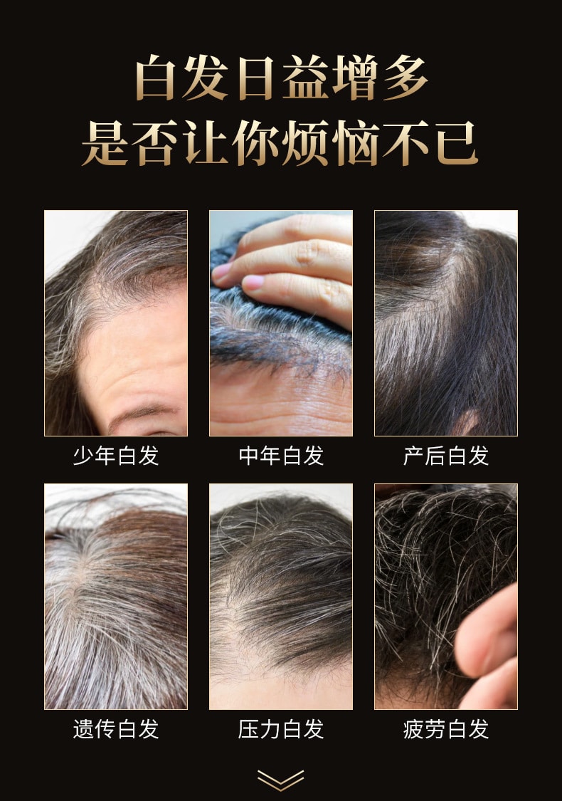 【中國直郵】南京同仁堂 e靈芝首烏精華液 滋養髮根亮澤清爽 呵護秀發 100ml/瓶