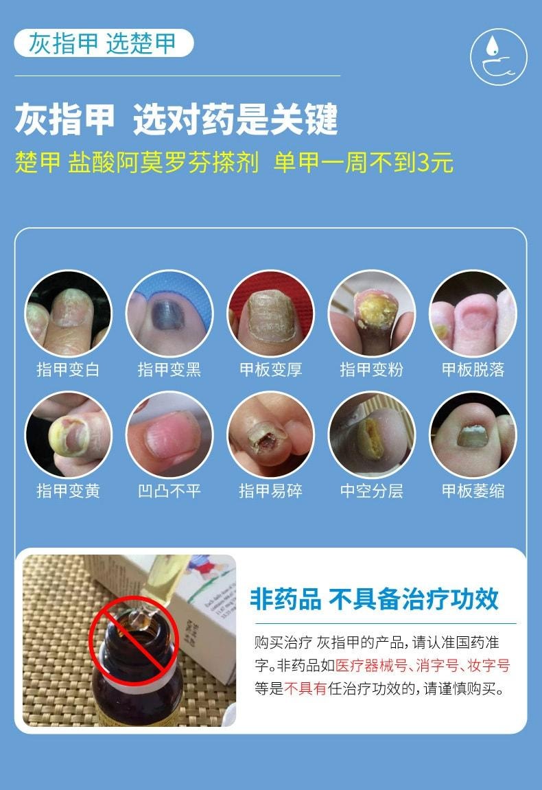 【中國直郵】 楚甲 鹽酸阿莫羅芬搽劑 治療灰指甲專用藥 高滲透性 直達甲床 0.5ml/盒