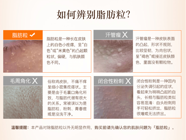 【日本直邮】CHEZMOI TSUBU NIGHT PACK 去脂肪粒眼霜眼膜 30g