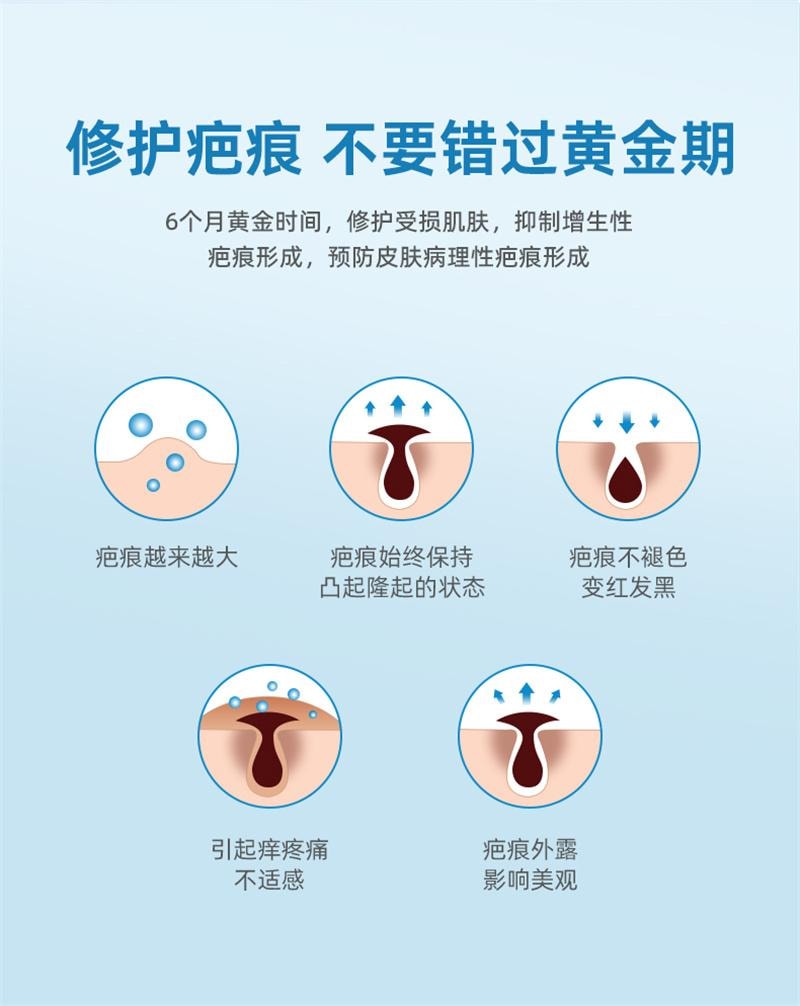 【中国直邮】 亿普 疤痕贴 医用祛疤贴 硅凝胶剖腹产去疤修复儿童手术增生除疤隐形贴 3贴/盒