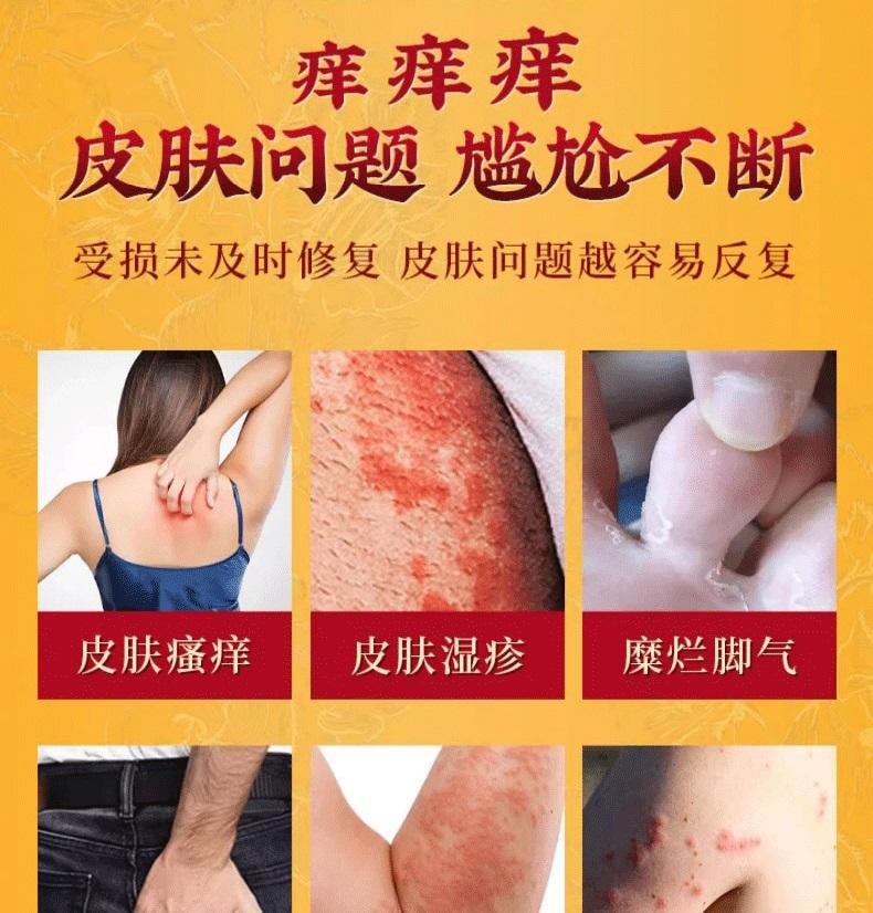 【中国直邮】 祥医堂 断痒王 止痒膏皮肤痒断痒膏 一抹止痒 草本秘制 安全健康 30g/盒