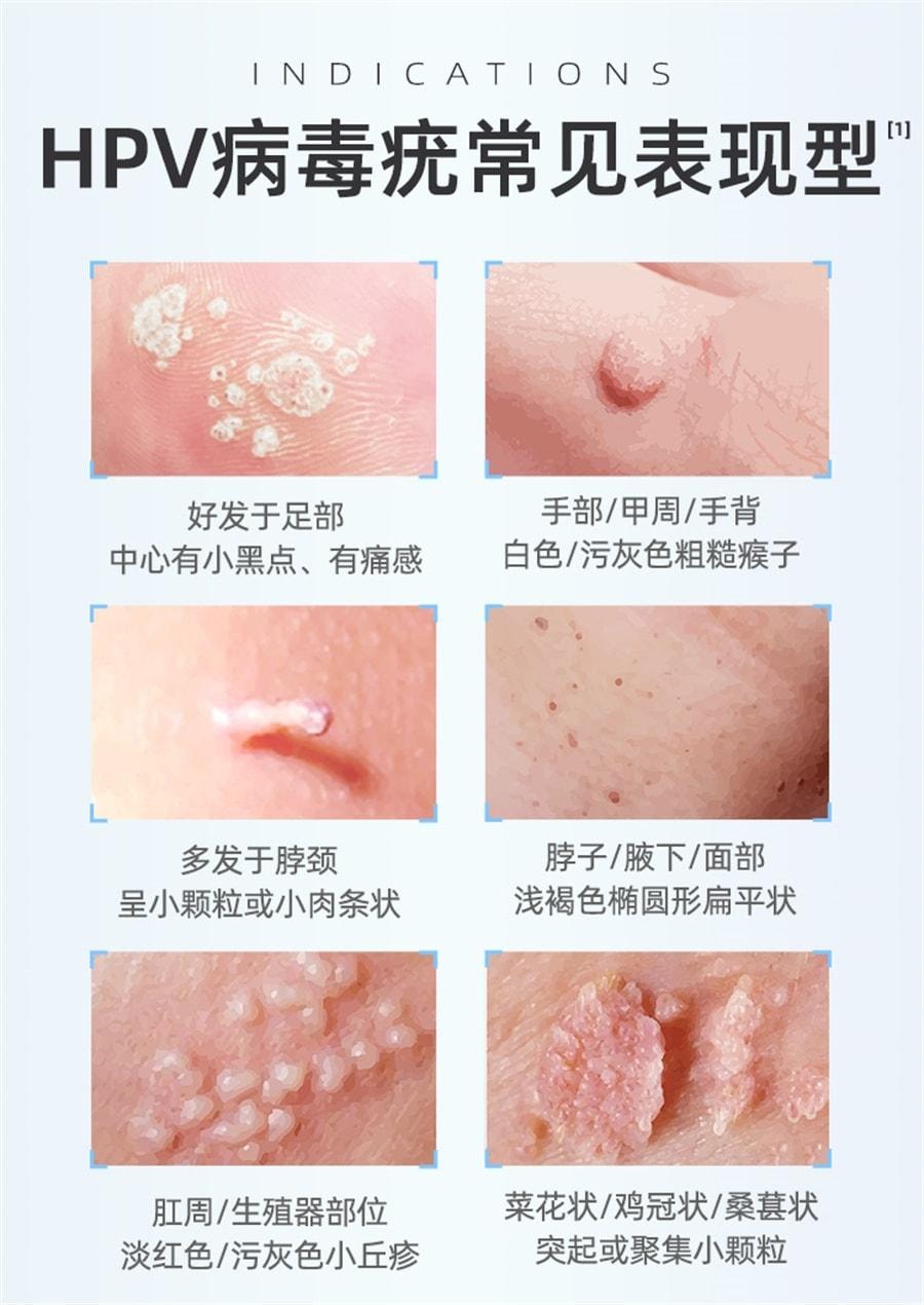 【中国直邮】 丽芙 咪喹莫特乳膏 扁平疣丝状疣尖锐湿疣咪喹莫特乳膏涂 8袋/盒