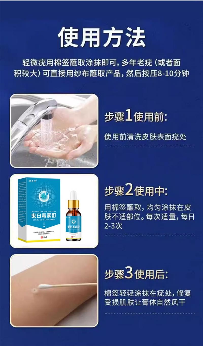 祥医堂 鬼臼毒素酊10ml/盒 去鸡眼尖锐丝状扁平克疣抑菌外用