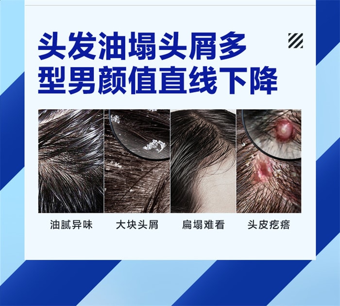 【中國直郵】海洋至尊 ZSEA 控油去屑洗髮精 男士專用蓬鬆止癢持久留香洗髮露 400ml/瓶(時尚達人強烈推薦)