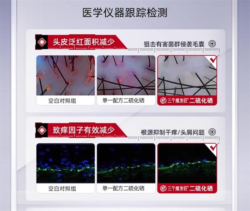 【中国直邮】 三个魔发匠 二硫化硒去屑洗发水毛囊清洁控油蓬松止痒洗头膏 400ml