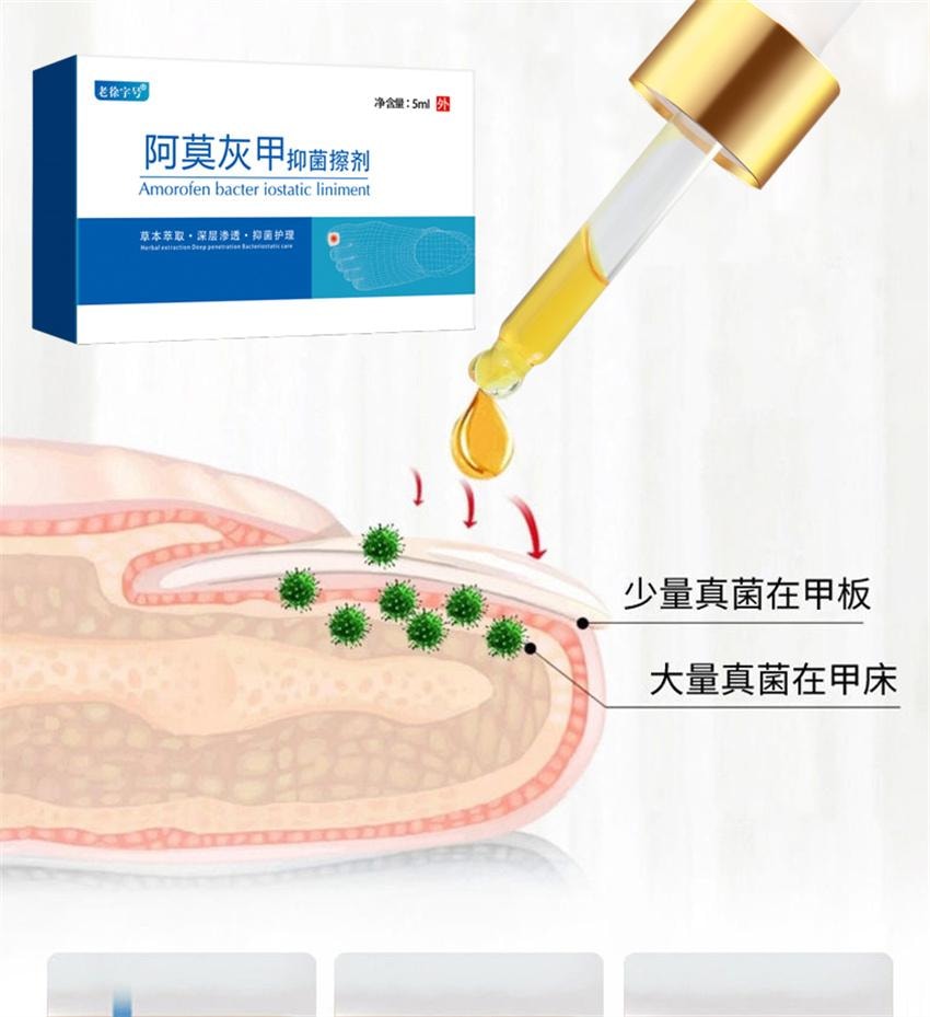 【中国直邮】 祥医堂 阿莫灰甲抑菌擦剂 修复灰指甲脱甲液 阿莫罗芬搽剂灰指甲正品 5ml/盒