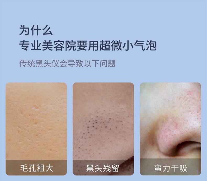 【中國直郵】DOCO小氣泡吸黑頭儀毛孔清潔神器 灰色