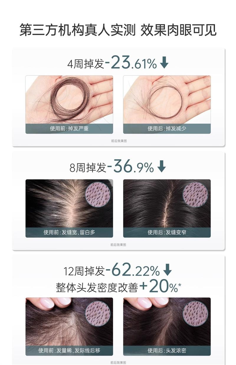 【中國直郵】 袋鼠媽媽 產後防脫洗護套裝去屑洗髮露專用蓬鬆柔順護髮素 洗髮露350ml+潤髮乳200g