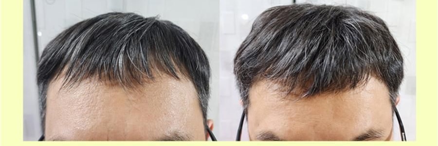 韩国GRABITY 防脱固发洗发水 加强型 475ml​​ 缓解脱发 极细发质/短发专研