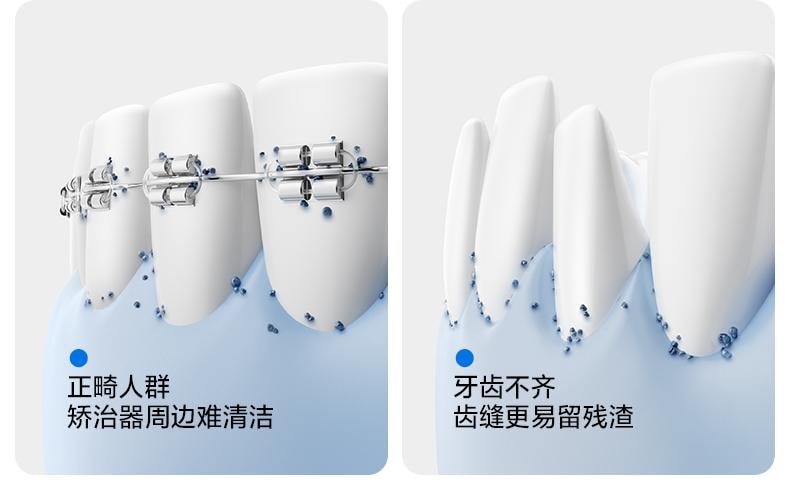 【美國直郵】 USMILE笑容加 沖牙器C10藍色便攜式水牙線 1支裝