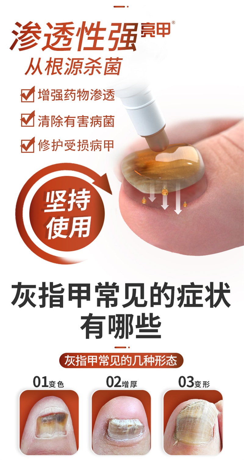 【中國直郵】亮甲 複方聚維酮碘搽劑灰指甲專用藥去甲癬治療指甲藥殺滅真菌 3mL x 1盒
