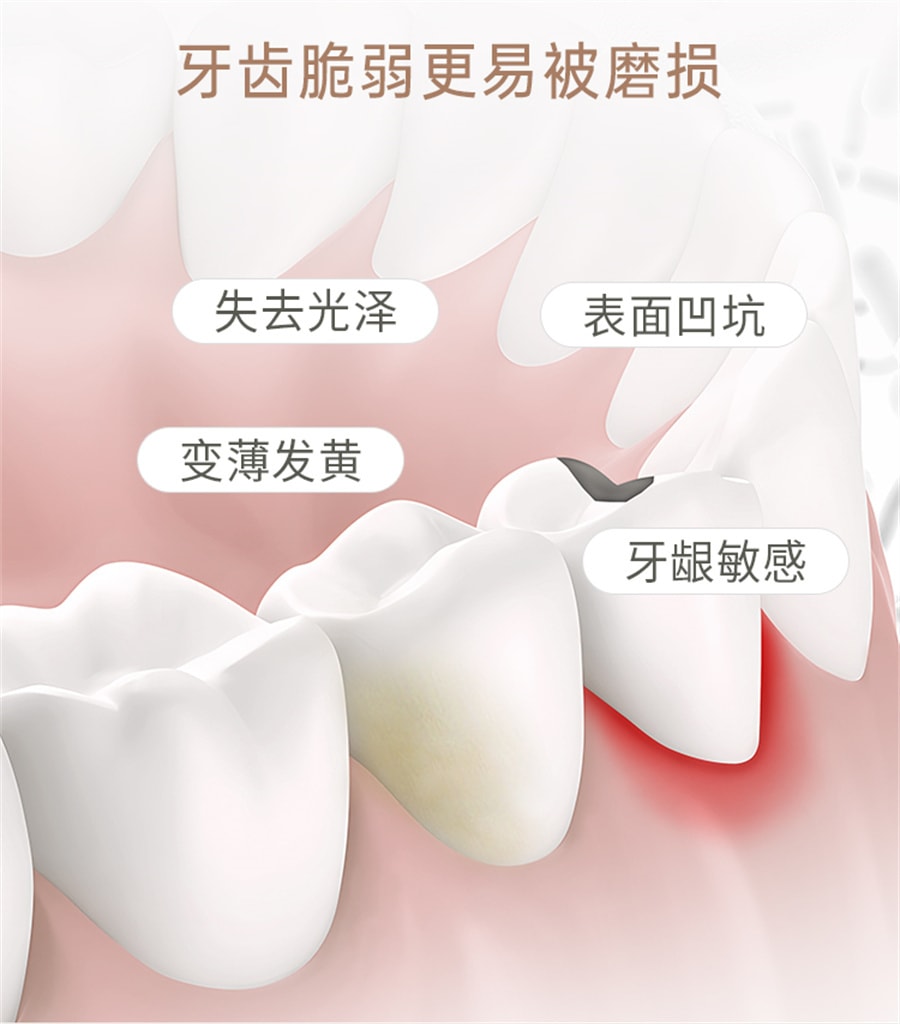 【中國直郵】袋鼠媽媽 準孕婦牙膏專用不含氟清新口氣口腔護理牙齒可用 100g/支