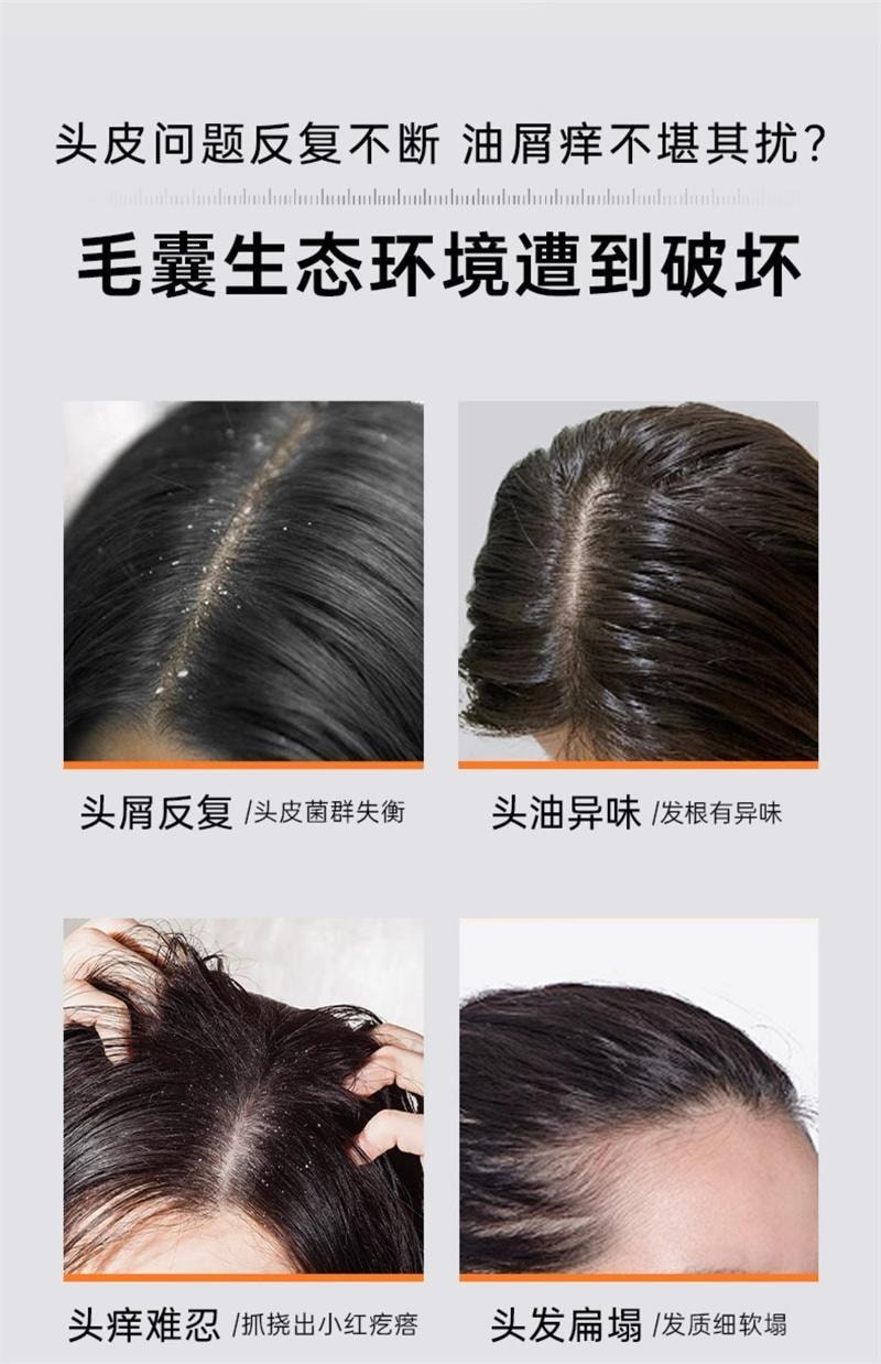 【中國直郵】 質潤 二硫化硒洗髮精 去屑止癢控油蓬鬆去屑止癢洗頭水 水楊酸洗髮露 250ml/瓶【小紅書爆款推薦】