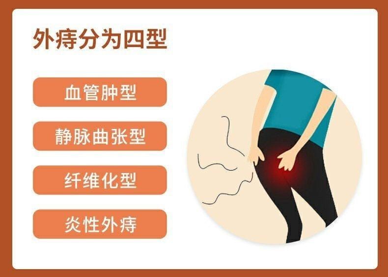 【中国直邮】 马应龙 麝香痔疮栓 痔疮消肿止痛止血 神器消肉球痔疮药 18粒/盒