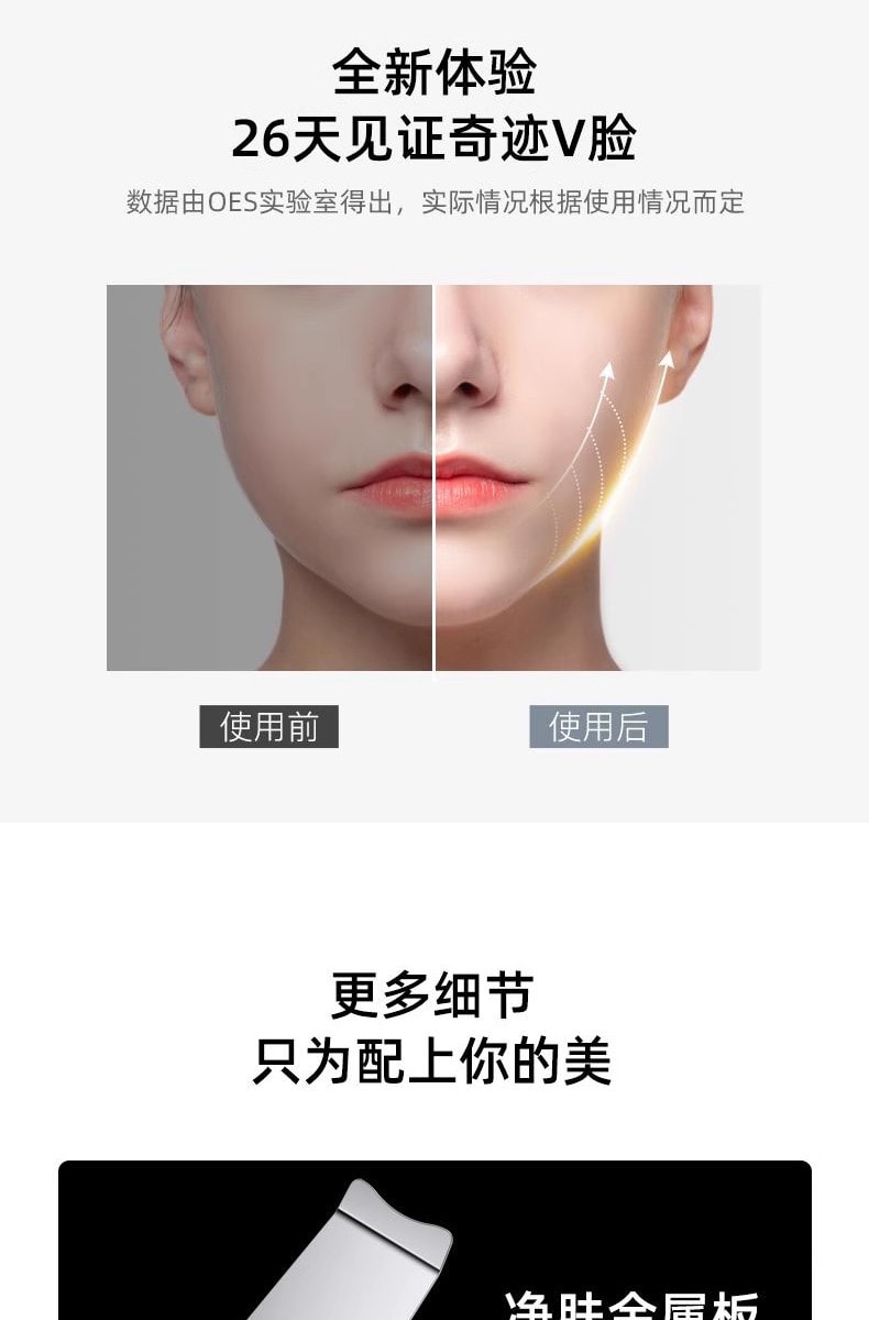 【黃聖依同款】中國直郵 OES 超音波離子清潔儀 吸黑頭神器 臉部導入美容儀 白色1件(小紅書網紅推薦)