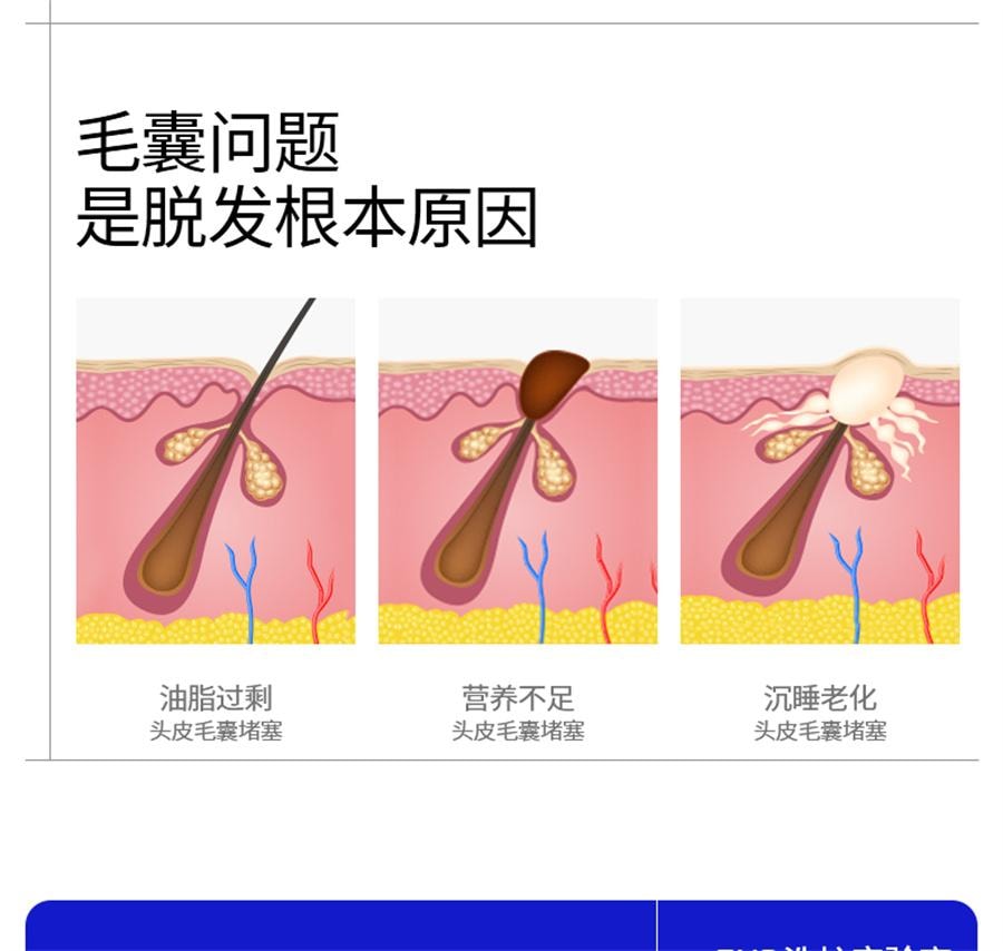  EHD 防脱防断固发洗发水 防断固发柔顺蓬松女洗头露500ml/瓶