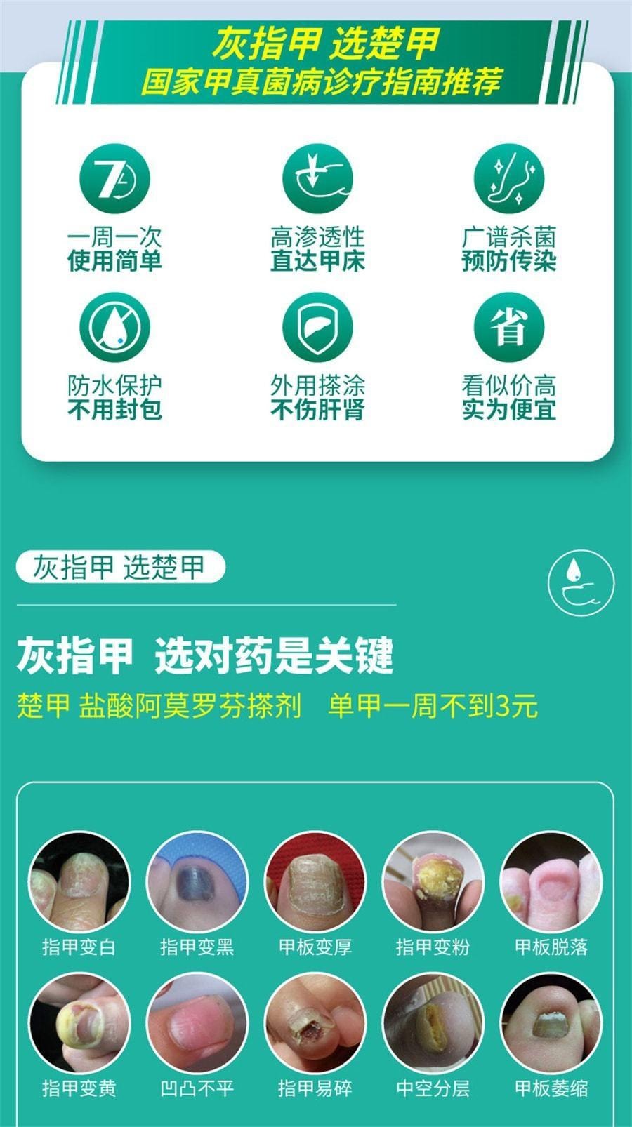 【中国直邮】 楚甲 盐酸阿莫罗芬搽剂 灰指甲专用药脚气甲癣甲真菌病 2.5mL/盒(医师推荐拍2盒)