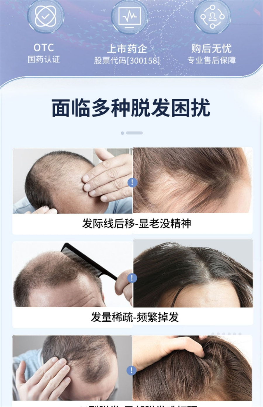 【中国直邮】 达霏欣 米诺地尔搽剂男女性脂溢性脱发生发液上药器  5%*60ml/盒男士