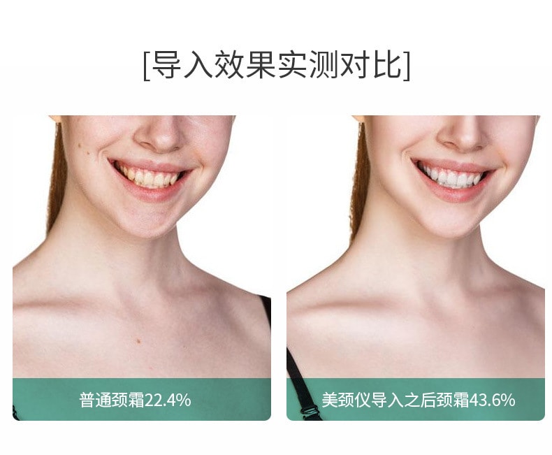 【中国直邮】梵洛  彩光颈部护理去颈纹美容仪颈部按摩去细纹美颈仪   白色